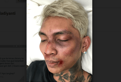 Berbohong Soal Dipukuli Penggemar K-Pop, Young Lex: Ngapain Minta Maaf